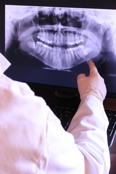 Best Emergency Treatment for Toothache in Polk City, IA